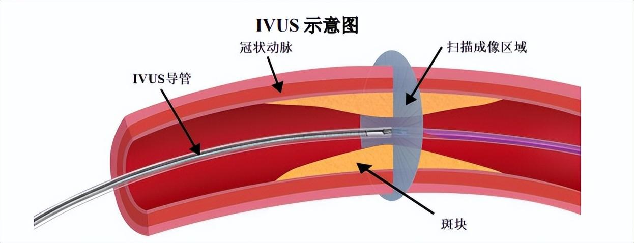 如何查看pci设备_如何查看pcie