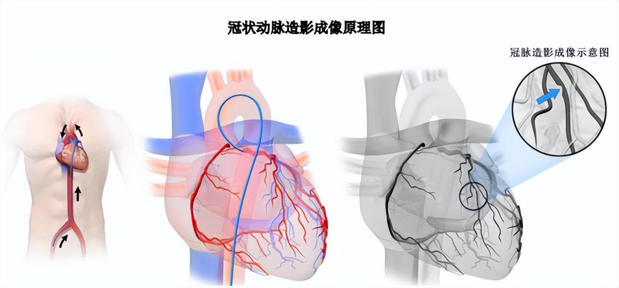 如何查看pci设备_如何查看pcie