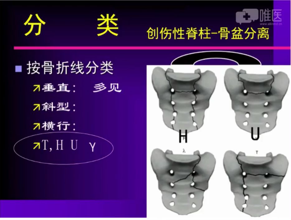 倒车移位讲解示范_倒车移位技巧图解