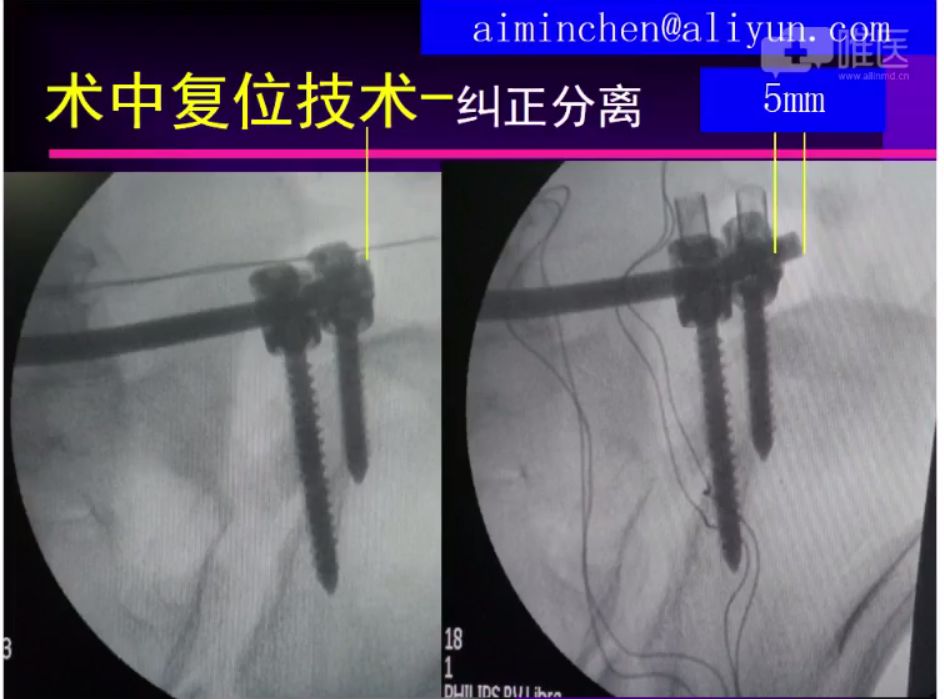 倒车移位讲解示范_倒车移位技巧图解