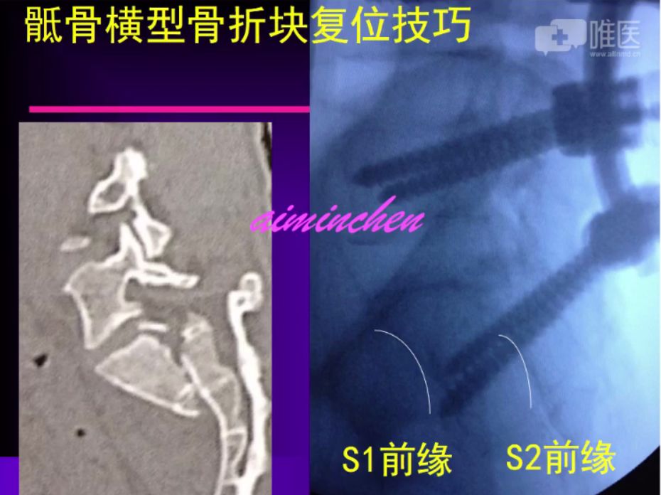 倒车移位讲解示范_倒车移位技巧图解