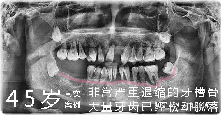 dl250 拆电瓶_电瓶电池