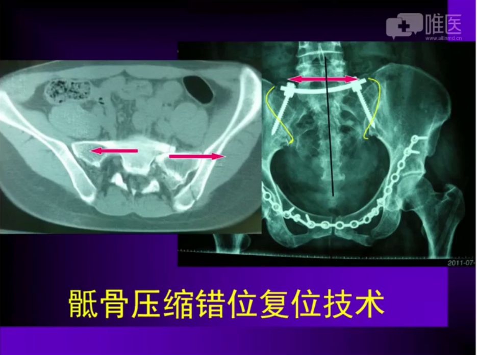 倒车移位讲解示范_倒车移位技巧图解