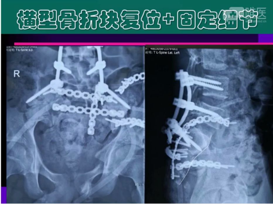 倒车移位讲解示范_倒车移位技巧图解