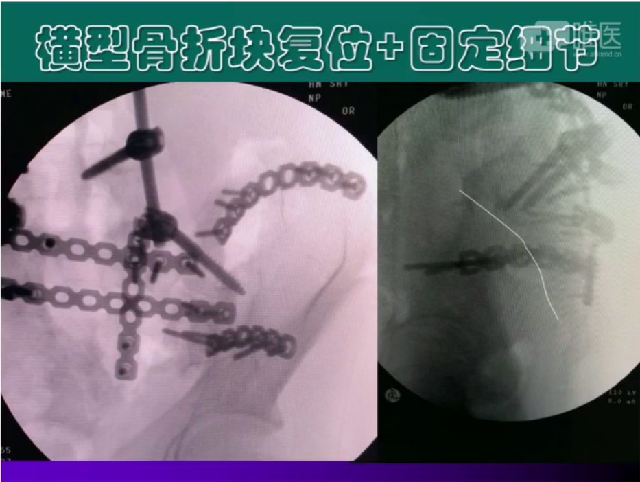 倒车移位讲解示范_倒车移位技巧图解