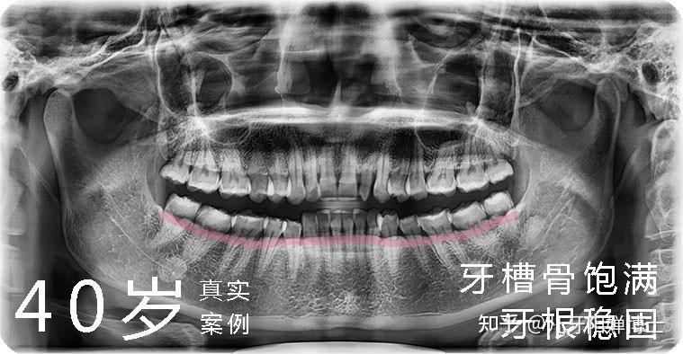 dl250 拆电瓶_电瓶电池