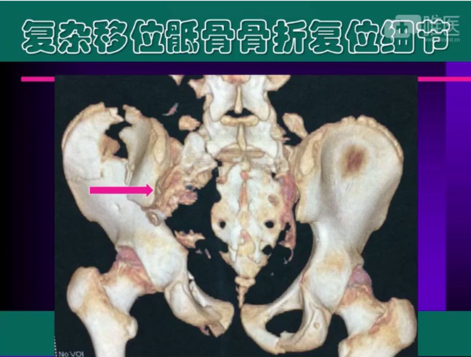 倒车移位讲解示范_倒车移位技巧图解