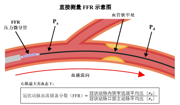 如何查看pci设备_如何查看pcie